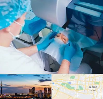 دکتر عمل لازک چشم در غرب تهران