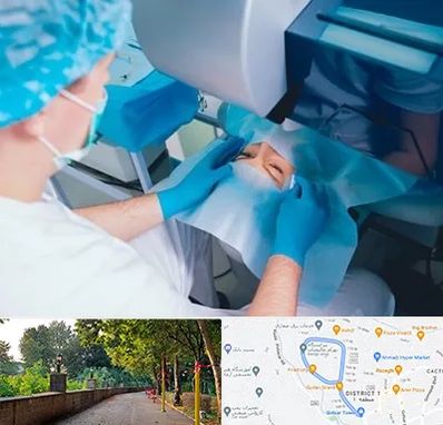 دکتر عمل لازک چشم در بلوار گیلان رشت