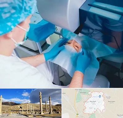 دکتر عمل لازک چشم در مرودشت