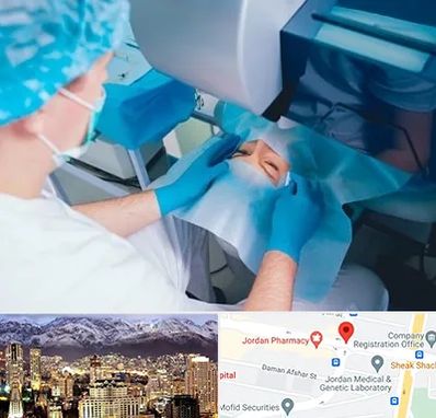 دکتر عمل لازک چشم در جردن