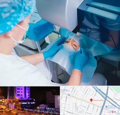 دکتر عمل لازک چشم در آبرسان تبریز