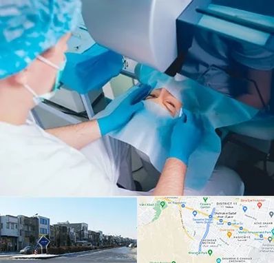 دکتر عمل لازک چشم در شریعتی مشهد