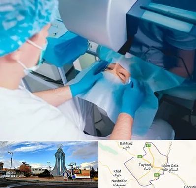 دکتر عمل لازک چشم در تایباد