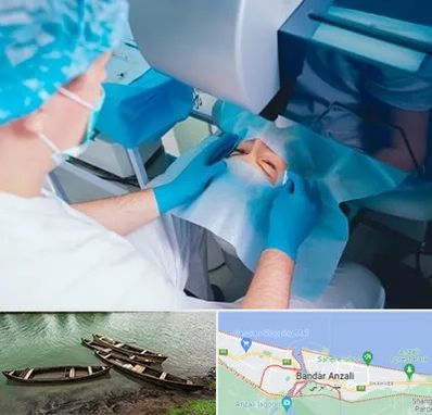 دکتر عمل لازک چشم در بندر انزلی