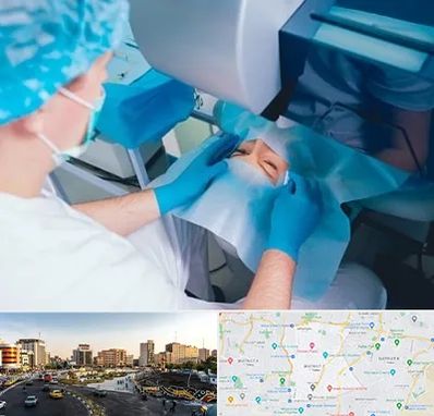 دکتر عمل لازک چشم در منطقه 7 تهران