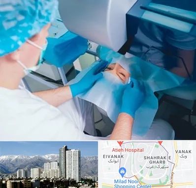 دکتر عمل لازک چشم در شهرک غرب تهران