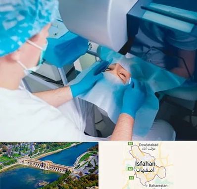 دکتر عمل لازک چشم در اصفهان