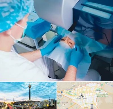 دکتر عمل لازک چشم در تهران