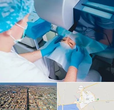 دکتر عمل لازک چشم در بندر ماهشهر