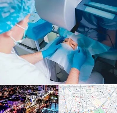 دکتر عمل لازک چشم در منظریه رشت