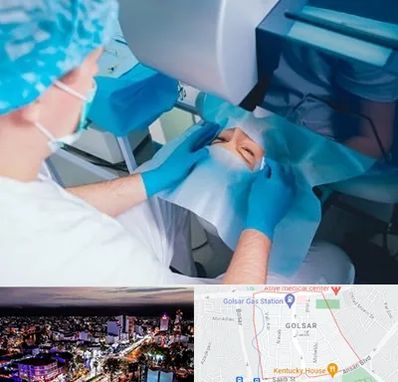 دکتر عمل لازک چشم در گلسار رشت