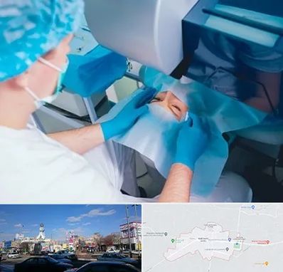 دکتر عمل لازک چشم در ماهدشت کرج