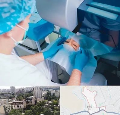 دکتر عمل لازک چشم در اوین