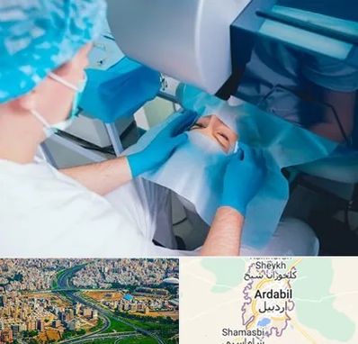 دکتر عمل لازک چشم در اردبیل