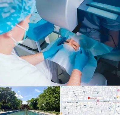 دکتر عمل لازک چشم در هشت بهشت اصفهان