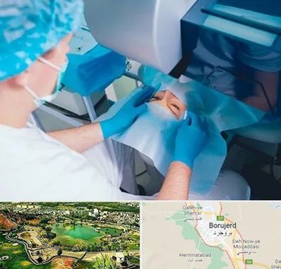 دکتر عمل لازک چشم در بروجرد