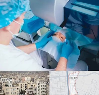 دکتر عمل لازک چشم در اسکندری