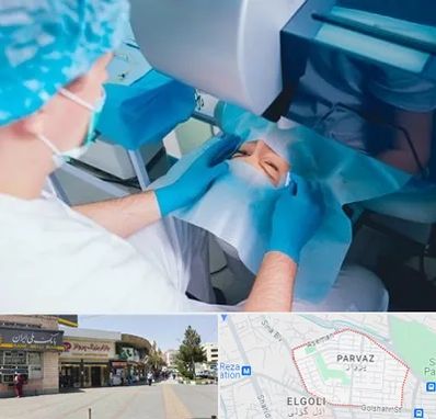 دکتر عمل لازک چشم در پرواز تبریز