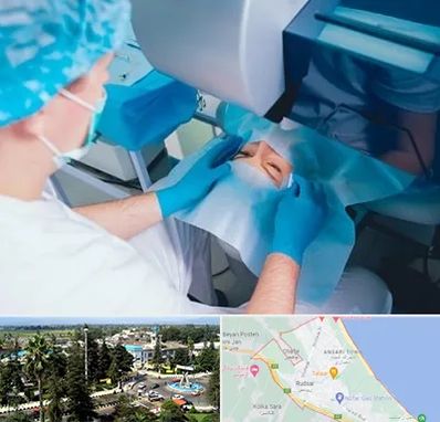 دکتر عمل لازک چشم در رودسر