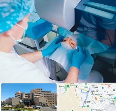 دکتر عمل لازک چشم در صیاد شیرازی مشهد