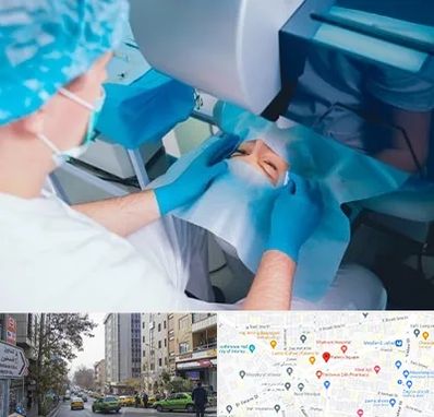 دکتر عمل لازک چشم در فاطمی