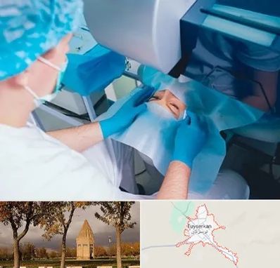دکتر عمل لازک چشم در تویسرکان