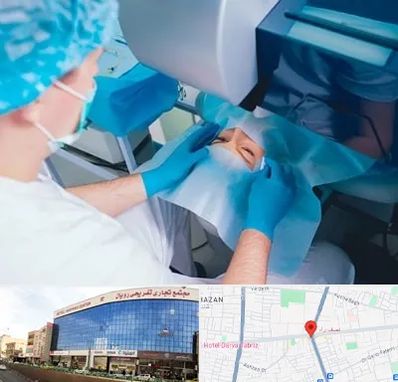 دکتر عمل لازک چشم در نصف راه تبریز