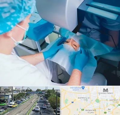 دکتر عمل لازک چشم در جنوب تهران