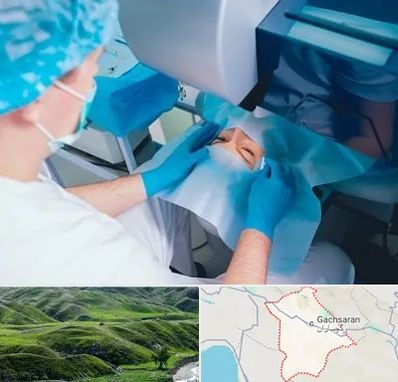 دکتر عمل لازک چشم در گچساران