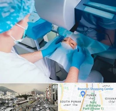 دکتر عمل لازک چشم در پونک