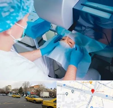 دکتر عمل لازک چشم در شهناز تبریز