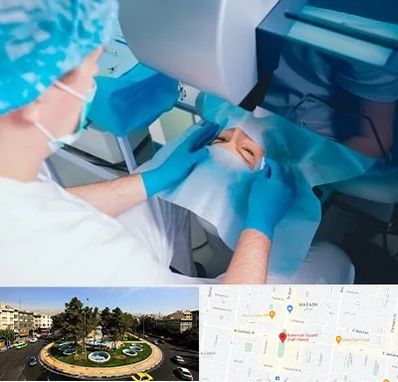 دکتر عمل لازک چشم در هفت حوض