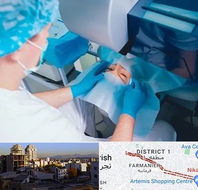 دکتر عمل لازک چشم در فرمانیه