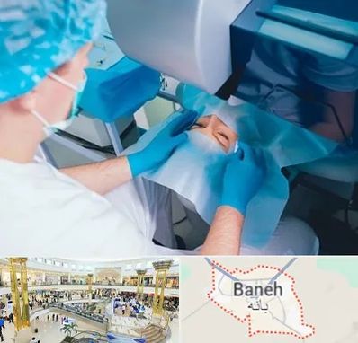 دکتر عمل لازک چشم در بانه