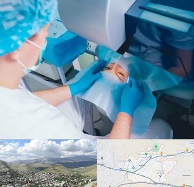 دکتر عمل لازک چشم در رودهن