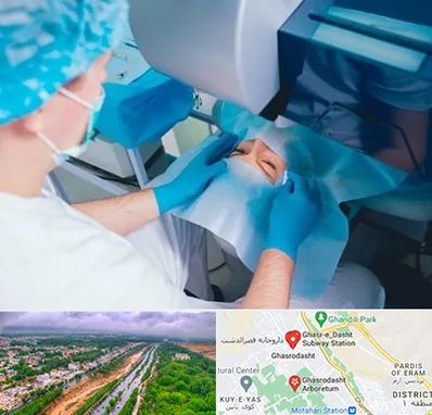 دکتر عمل لازک چشم در قصرالدشت شیراز