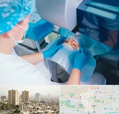 دکتر عمل لازک چشم در منطقه 5 تهران