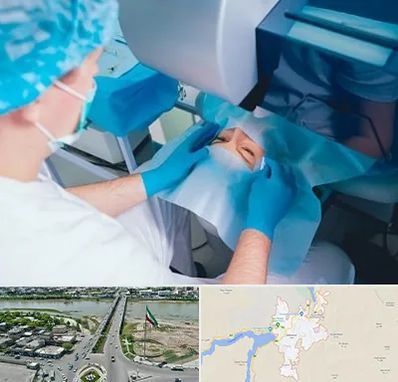 دکتر عمل لازک چشم در میاندوآب