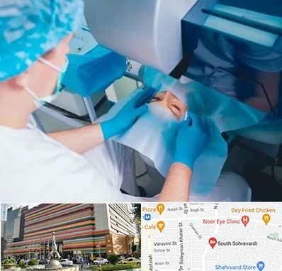 دکتر عمل لازک چشم در سهروردی