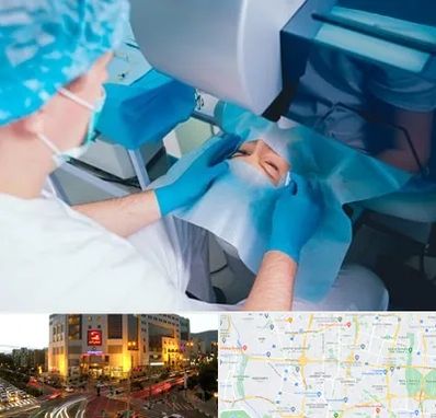 دکتر عمل لازک چشم در جنت آباد تهران