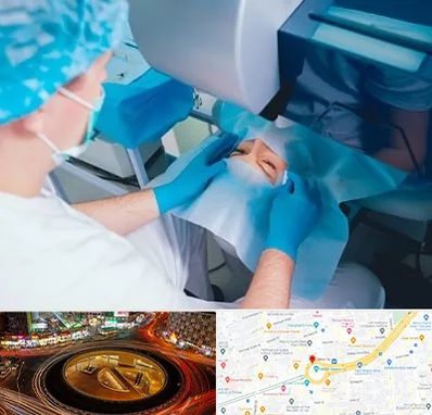 دکتر عمل لازک چشم در میدان ولیعصر