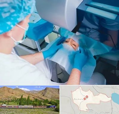 دکتر عمل لازک چشم در خاش