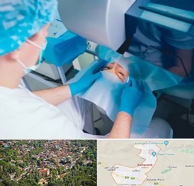 دکتر عمل لازک چشم در دماوند