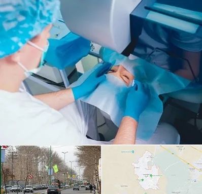 دکتر عمل لازک چشم در نظرآباد کرج