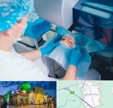 دکتر عمل لازک چشم در آستانه اشرفیه