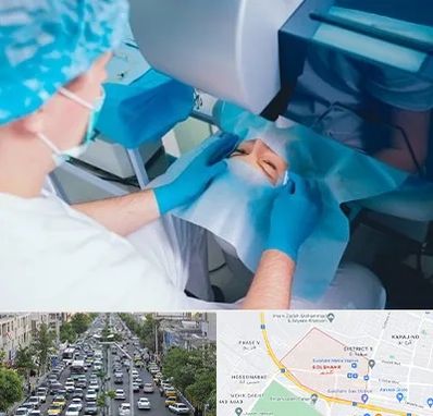 دکتر عمل لازک چشم در گلشهر کرج