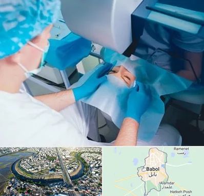 دکتر عمل لازک چشم در بابل