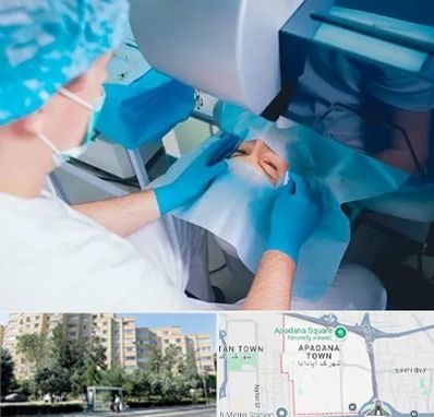 دکتر عمل لازک چشم در آپادانا