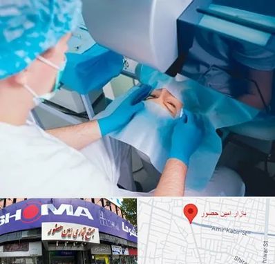 دکتر عمل لازک چشم در امین حضور