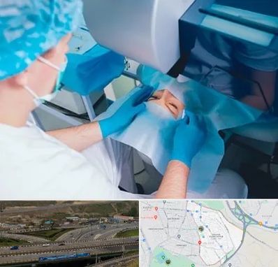 دکتر عمل لازک چشم در یاغچیان تبریز